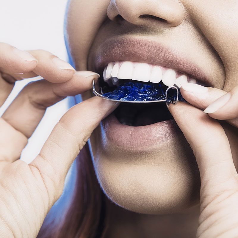 Retainer